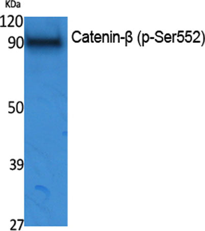 Catenin-β (phospho Ser552) rabbit pAb