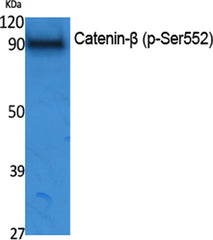 Catenin-β (phospho Ser552) rabbit pAb
