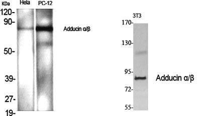 Adducin α/β rabbit pAb