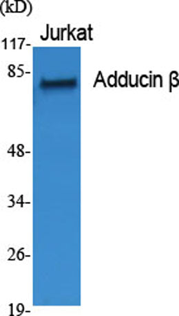 Adducin β rabbit pAb