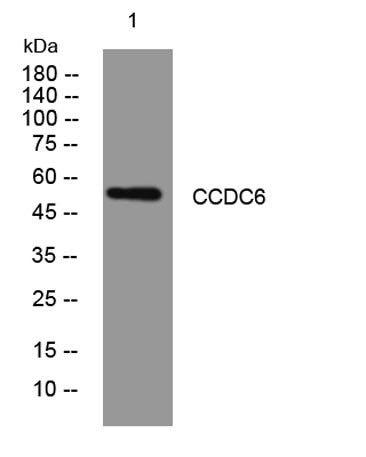 CCDC6 rabbit pAb