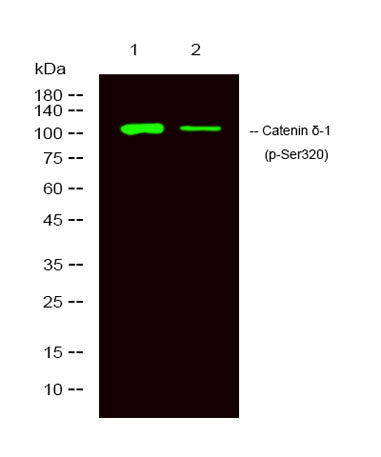 Catenin δ-1 (phospho-Ser320) rabbit pAb