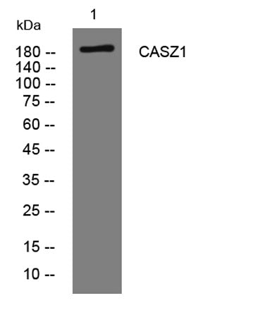 CASZ1 rabbit pAb