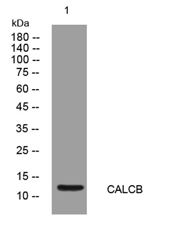 CALCB rabbit pAb