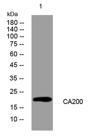 CA200 rabbit pAb