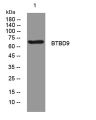 BTBD9 rabbit pAb