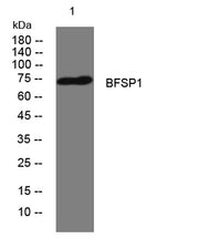 BFSP1 rabbit pAb