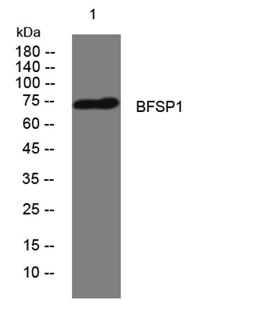 BFSP1 rabbit pAb