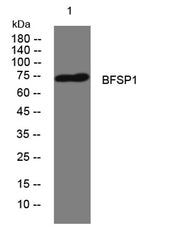 BFSP1 rabbit pAb