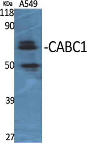 CABC1 rabbit pAb