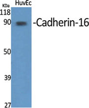Cadherin-16 rabbit pAb