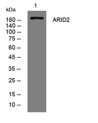 ARID2 rabbit pAb