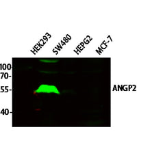 ANGP2 rabbit pAb
