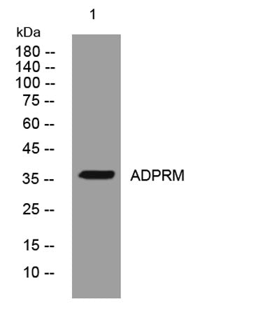 ADPRM rabbit pAb