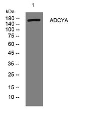 ADCYA rabbit pAb