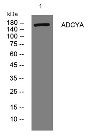 ADCYA rabbit pAb