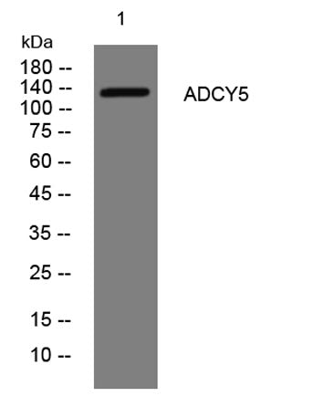 ADCY5 rabbit pAb