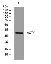 ACTY rabbit pAb
