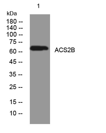ACS2B rabbit pAb