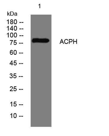 ACPH rabbit pAb
