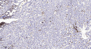 MMP1 (Cleaved-Ile271) rabbit pAb