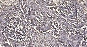 MMP28 (Cleaved-Phe123) rabbit pAb