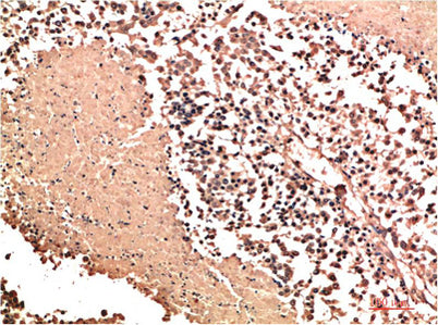 NM23A Rabbit rabbit pAb