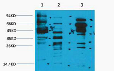 Acetyl Kine rabbit pAb