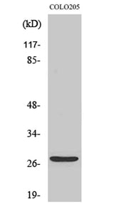 TP53INP1 rabbit pAb
