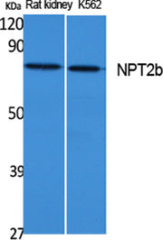 NPT2b rabbit pAb