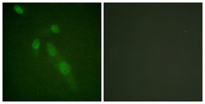 Acetyl Lys proteins rabbit pAb