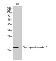 Choriogonadotropin β rabbit pAb