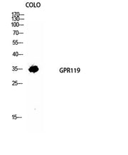 GPR119 rabbit pAb