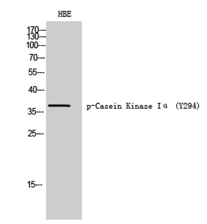 Casein Kinase Iα (phospho Tyr294) rabbit pAb