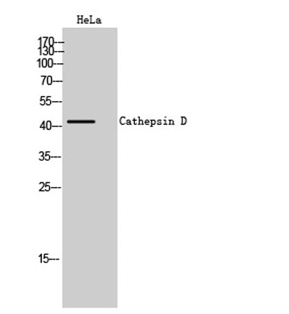 Cathepsin D rabbit pAb