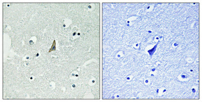 ALK (phospho Tyr1604) rabbit pAb