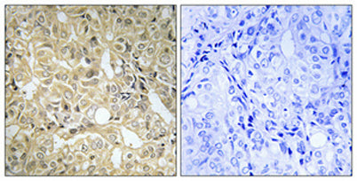 DHA Kinase rabbit pAb