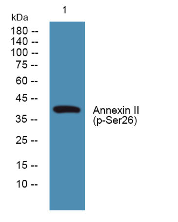 Annexin II (phospho Ser26) rabbit pAb