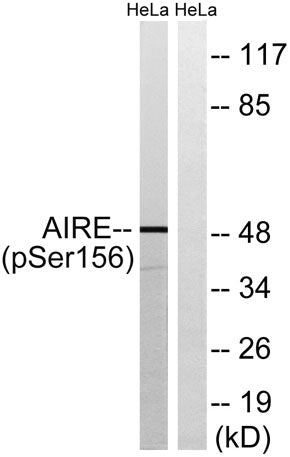 AIRE-1 (phospho Ser156) rabbit pAb
