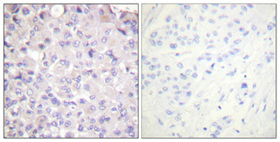 IKKβ (phospho Tyr188) rabbit pAb