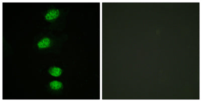 AR (phospho Ser94) rabbit pAb
