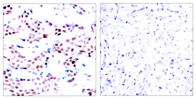 AP-1 (phospho Thr91) rabbit pAb