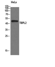 TBPL2 rabbit pAb