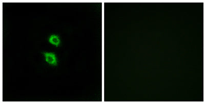 Arylsulfatase D rabbit pAb