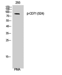 CD71/TfR (phospho Ser24) rabbit pAb