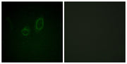 Moesin/Ezrin/Radixin (phospho Thr558) rabbit pAb