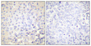 IκB-ε (phospho Ser22) rabbit pAb