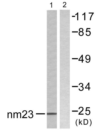 NM23-H2 rabbit pAb