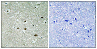 B23 (phospho Thr234) rabbit pAb