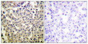 PAKα/β/γ (phospho Thr423/402/421) rabbit pAb
